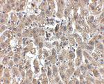 LDLR Antibody in Immunohistochemistry (IHC)