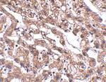 MACC1 Antibody in Immunohistochemistry (IHC)