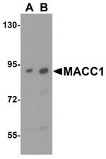 MACC1 Antibody in Western Blot (WB)