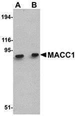 MACC1 Antibody in Western Blot (WB)