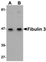 Fibulin 3 Antibody in Western Blot (WB)