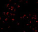 SCARA5 Antibody in Immunocytochemistry (ICC/IF)