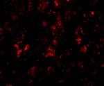 AFAP1L2 Antibody in Immunohistochemistry (IHC)