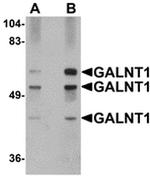 GALNT10 Antibody in Western Blot (WB)