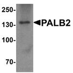 PALB2 Antibody in Western Blot (WB)