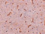 TWA1 Antibody in Immunohistochemistry (IHC)