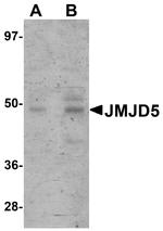 JMJD5 Antibody in Western Blot (WB)