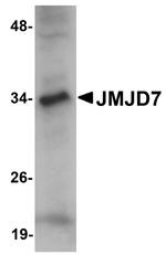 JMJD7 Antibody in Western Blot (WB)