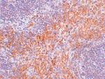 RIP1 Antibody in Immunohistochemistry (IHC)