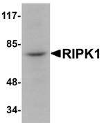 RIP1 Antibody in Western Blot (WB)