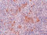 AGTR1 Antibody in Immunohistochemistry (IHC)