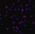 AGTR2 Antibody in Immunocytochemistry (ICC/IF)