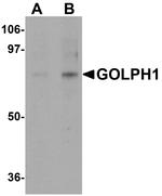 ACBD3 Antibody in Western Blot (WB)