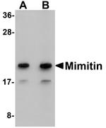 NDUFAF2 Antibody in Western Blot (WB)