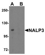 NLRP3 Antibody in Western Blot (WB)