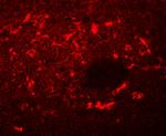 SQSTM1 Antibody in Immunocytochemistry (ICC/IF)