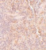 SQSTM1 Antibody in Immunohistochemistry (Paraffin) (IHC (P))