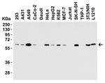 SQSTM1 Antibody in Western Blot (WB)