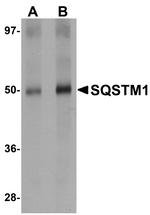 SQSTM1 Antibody in Western Blot (WB)