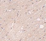 FRMPD4 Antibody in Immunohistochemistry (IHC)