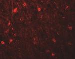 SIPA1L1 Antibody in Immunohistochemistry (IHC)