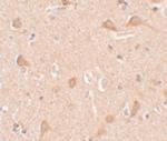 SIPA1L1 Antibody in Immunohistochemistry (IHC)