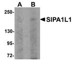 SIPA1L1 Antibody in Western Blot (WB)