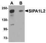 SIPA1L2 Antibody in Western Blot (WB)