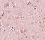 PLEKHM2 Antibody in Immunohistochemistry (IHC)