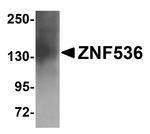 ZNF536 Antibody in Western Blot (WB)