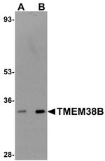 TMEM38B Antibody in Western Blot (WB)