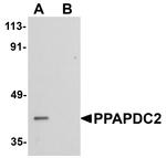 PPAPDC2 Antibody in Western Blot (WB)