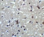 PRDM16 Antibody in Immunohistochemistry (IHC)