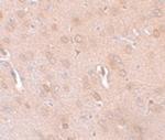 KCNK18 Antibody in Immunohistochemistry (IHC)