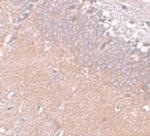 SYNGR4 Antibody in Immunohistochemistry (IHC)