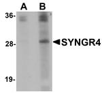 SYNGR4 Antibody in Western Blot (WB)