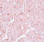 LXR alpha Antibody in Immunohistochemistry (IHC)