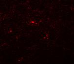 NAT11 Antibody in Immunohistochemistry (IHC)