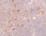 NAT11 Antibody in Immunohistochemistry (IHC)