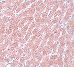 OCT4 Antibody in Immunohistochemistry (IHC)