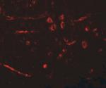 CDX2 Antibody in Immunohistochemistry (IHC)