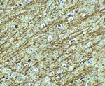 GATA3 Antibody in Immunohistochemistry (IHC)