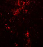 BFAR Antibody in Immunohistochemistry (IHC)