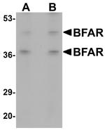 BFAR Antibody in Western Blot (WB)