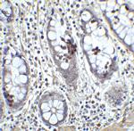 KLF4 Antibody in Immunohistochemistry (IHC)