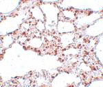 ZSCAN4 Antibody in Immunohistochemistry (IHC)