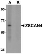 ZSCAN4 Antibody in Western Blot (WB)