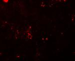 BCAS2 Antibody in Immunohistochemistry (IHC)