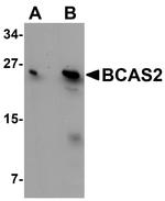 BCAS2 Antibody in Western Blot (WB)