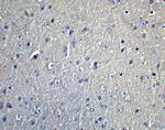 DCLK1 Antibody in Immunohistochemistry (IHC)